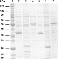 SDS-PAGE analysis of recombinant proteins: unpurified protein fractions achieved after culture of transfected BL21(DE3) codon plus E.