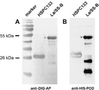 Northwestern blotting analysis of recombinant HSPC133 and La/SS-B protein to investigate the binding capability to RNA.