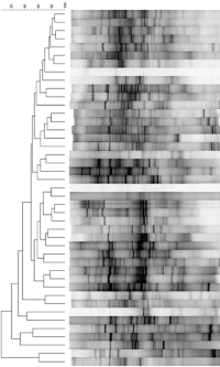 Dendrograms obtained by the UPGMA method for clustering of DGGE-banding patterns of oral samples using the Gel Compar II (version 5.10.) software package.