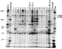 SDS-PAGE fluorography of 35S IP with 0.5 mg/L of methionine in the labeling medium.