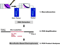 Workflow of microsatellite analyses of tumor in comparison to peri-tumorous non-tumor areas.