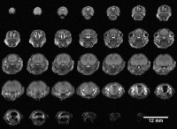 Montage of 0.5 mm contiguous slices from a single fetal rat head, acquired in parallel as part of a group of 14 and segmented out using ImageJ software.