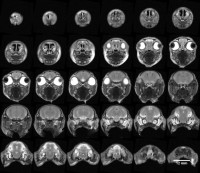 Montage of 1.0 mm contiguous slices from a single fetal rabbit head, acquired in parallel as part of a group of five and segmented out using ImageJ software.
