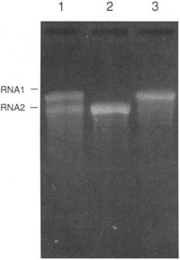 1.2% formaldehyde/MOPS agarose gel of CPMV RNAs extracted from whole virus (lane 1) and the two nucleoprotein components separated by ultracentrifugation on a Nycodenz gradient (lanes 2 and 3).