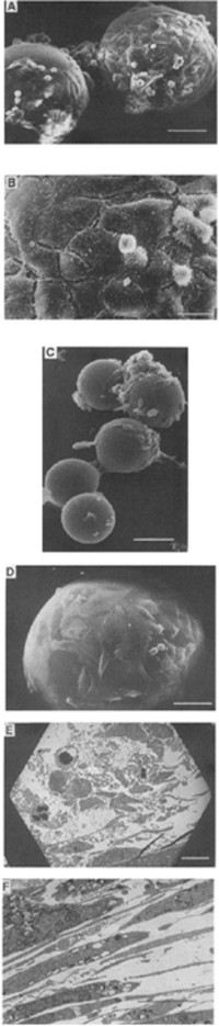 (A) HeLa cells grown to a high density on glass microcarriers (bar = 10 µm).