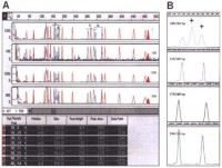 Reproducibility of the fast electrophoresis protocol.