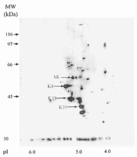 Two-dimension gel electrophoresis profile of cisplatin DNA-cross-linked proteins.