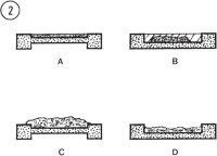 Properly (A,B) and improperly (C,D) loaded specimen carriers as seen in cut-away side view.