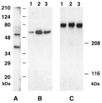 Example of Western blots of P.