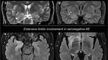 Case of pediatric cerebellar, hippocampal, and basal nuclei transient ...