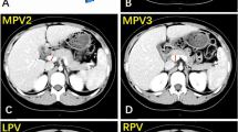 Reference values for normal main portal vein diameter in subjects aged ...