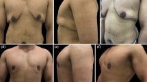research paper on weight loss surgery