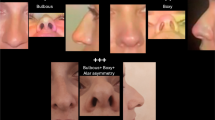 Fabrication of a Provisional and Immediate Nasal Prosthesis Following ...