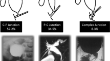 Clinico-radiological attributes of abnormal pancreaticobiliary junction ...
