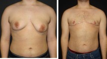 scholarly articles on gender reassignment surgery scholarly articles on gender reassignment surgery