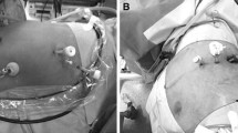 Surgical outcomes of robotic bilateral nephrectomy compared to open ...