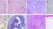 Consensus on clinical diagnosis and treatment of fumarate hydratase ...