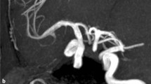 Callosomarginal artery: an in-depth of anatomical characteristics ...