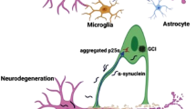 parkinson's disease research paper outline