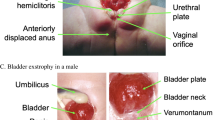 The exstrophy-epispadias complex | Current Urology Reports | Springer ...