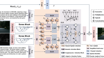 SGAFusion: a semantic-guided adaptive fusion framework for infrared and ...