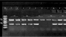 Interferon lambda polymorphisms associate with body iron indices ...