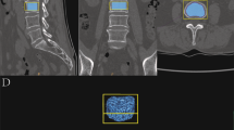 Prediction of osteoporosis and osteopenia by routine computed ...
