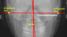 The relationship between jaw deformity and scoliosis | Oral Radiology