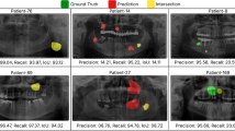 Evaluation of deep learning-based segmentation models for carotid ...