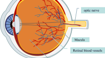 eye disease research paper