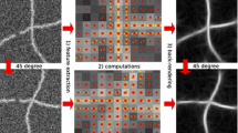 Tensorial Template Matching for Fast Cross-Correlation with Rotations ...