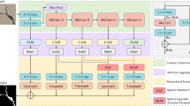 AHC-Net: a road crack segmentation network based on dual attention ...
