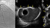 Impact of coronary calcium patterns on procedural outcomes in CTO-PCI ...