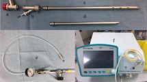 Anesthesia for Interventional Pulmonary Procedures | Springer Nature Link