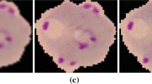 Image enhancement and segmentation using dark stretching technique for  Plasmodium Falciparum for thick blood smear