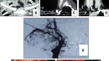 Carotid body tumor: characteristics and surgical outcome | Journal of ...