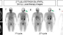 Therapeutic potential of [177Lu]Lu-DOTAGA-FAPi dimers in metastatic ...