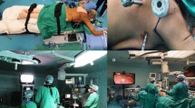 Laparoscopic Transhiatal Esophagectomy for Invasive Esophageal ...