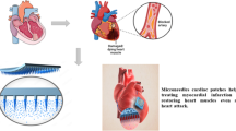 A microneedle substrate-based sutureless engineered cardiac patch for ...