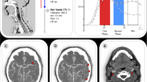 clinical presentations of stroke