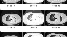 case study of a lung cancer patient