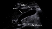 schematic representation of ectopic pregnancy