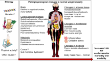 obesity presentation