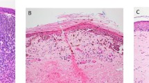 a report of histopathology