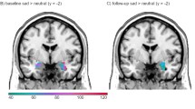 combined cognitive bias hypothesis in depression