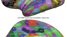Using multimodal cortical parcellations to identify novel regions of ...