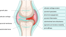 exercise for osteoarthritis a literature review of pathology and mechanism