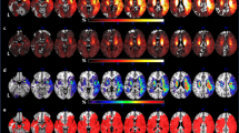 frontal lobe stroke case study