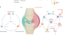 exercise for osteoarthritis a literature review of pathology and mechanism