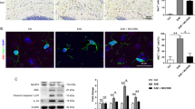 suppresses experimental autoimmune encephalomyelitis suppresses experimental autoimmune encephalomyelitis